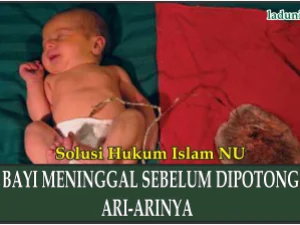 Hukum Penanganan Bayi Meninggal sebelum Dipotong Ari-arinya