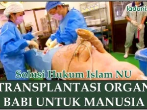 Transplantasi Organ Babi untuk Manusia