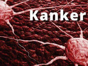 AI, Solusi Baru Untuk Memprediksi Kanker