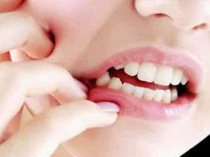 Obat Sakit Gigi Tradisional