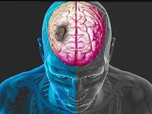 Rutin Makan Ikan Turunkan Risiko Stroke dan Gagal Jantung