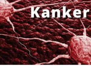 Ilmuwan Kembangkan Deteksi Dini Kanker dengan Alat Tes Pernapasan