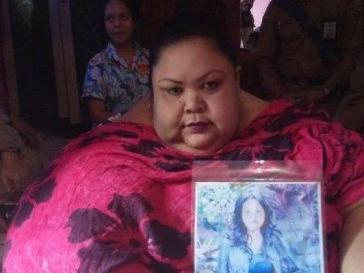 Mengenal Operasi Bariatrik yang Bantu Titi Wati Turunkan Berat Badan