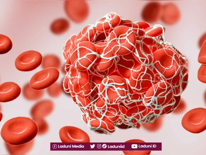 Inilah Solusi Darah Nifas yang Putus Sebelum Empat Puluh Hari