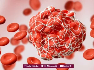 Inilah Solusi Darah Nifas yang Putus Sebelum Empat Puluh Hari