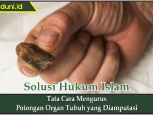 Tata Cara Mengurus Potongan Organ Tubuh yang Diamputasi