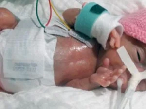 Bayi Terkecil di Dunia dari Jepang