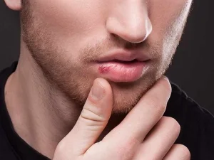 Cara Praktis Mencegah Keringnya Bibir Saat Berpuasa