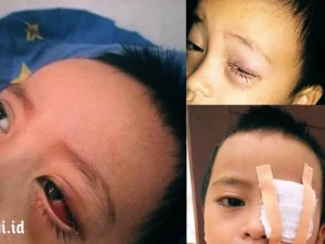 Kisah Seorang Ibu yang Menyesal Akibat Mata Buah Hatinya Alami Iritasi karena Kecanduan Gadget