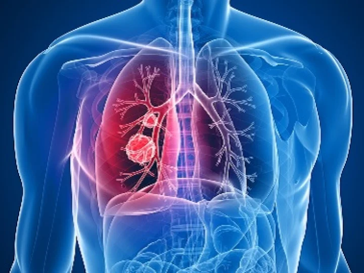 Belajar dari Kematian Suami BCL, Kenali Batas Maksimal Kerja Jantung