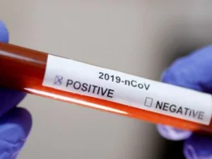 20 Jama'ah Alumni Gowa Asal Brebes Dinyatakan Positif Virus Corona