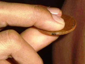 Merasa Masuk Angin? Jangan Buru-Buru Kerokan