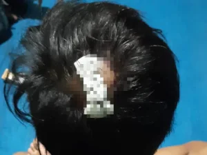 Berniat Minta Maaf Enam Kader PMII Cabang Curup Dianiaya, 1 Orang Luka Akibat Sajam