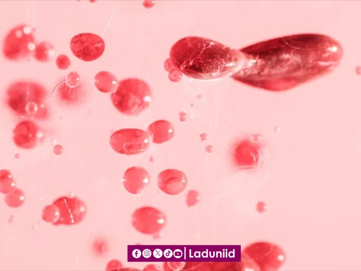 Darah Keguguran Usia Kandungan 1 Bulan: Apakah Termasuk Nifas